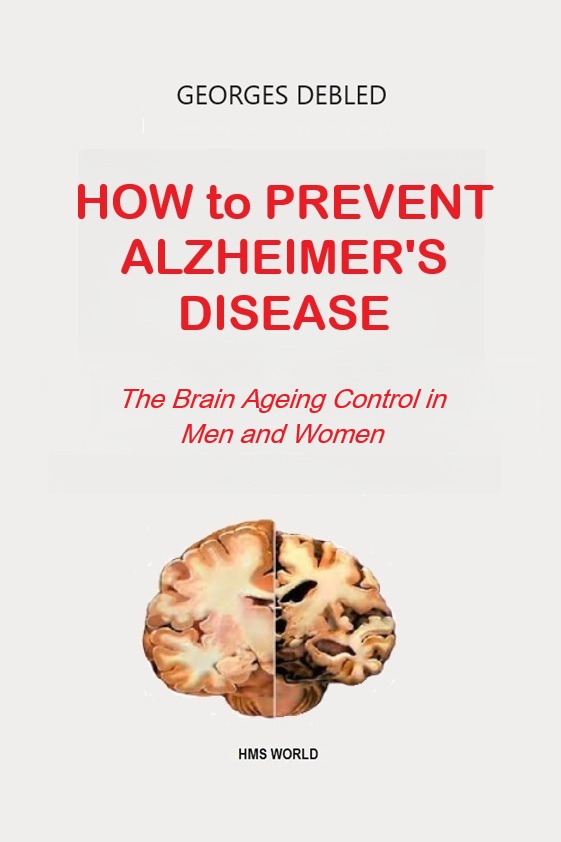 PREVENT ALZHEIMER